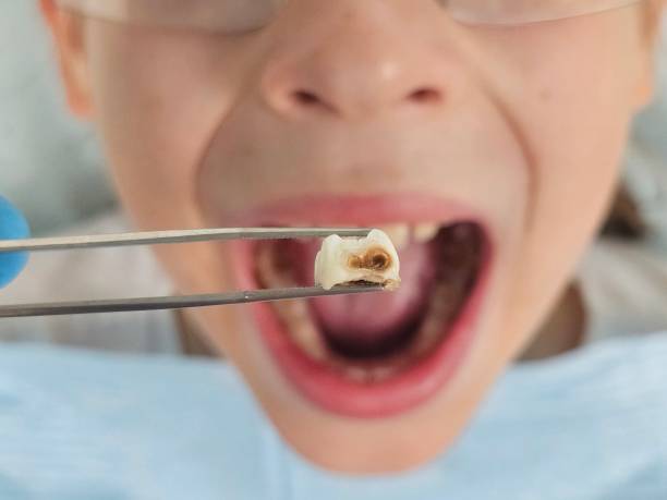 Best Teeth Whitening  in Home, WA